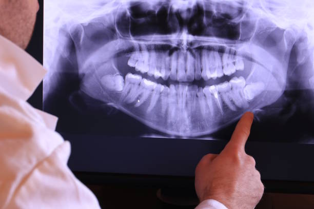 Best Emergency Treatment for Oral Infections in Donald, OR