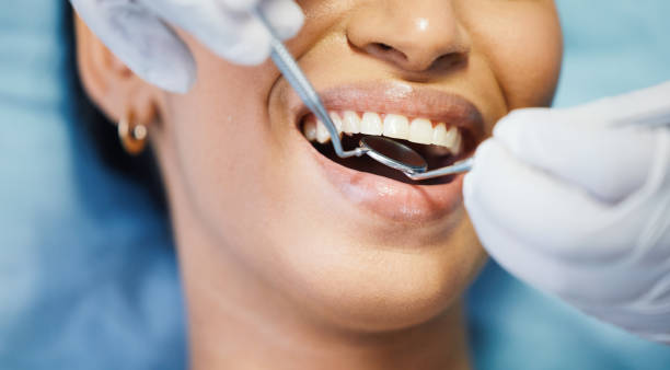Best Emergency Wisdom Tooth Extraction in Donald, OR